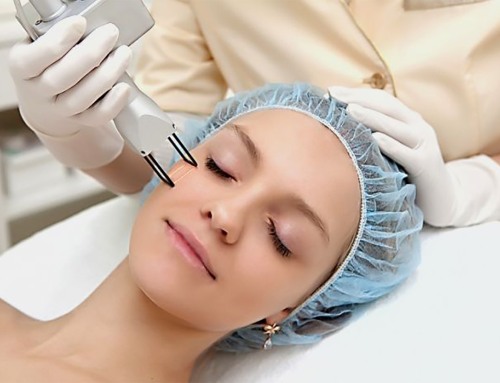 Narben im Gesicht nach Akne - wie man sie loswird: Cremes, Salben, Arzneimittel, Masken, kosmetische und medizinische Methoden