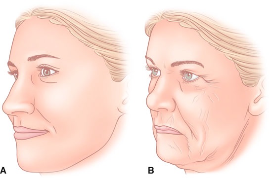 SMAS-lyft - ultraljud ansiktsrengöring. Funktioner i proceduren, indikationer, kontraindikationer, förväntad effekt, foto