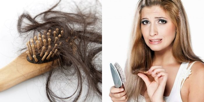 Vypadávání vlasů u žen - jak zastavit, co dělat: šampony, oleje, masky, komplexy vitamínů