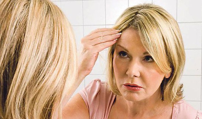 Perda de cabelo em mulheres - como parar, o que fazer: shampoos, óleos, máscaras, complexos vitamínicos