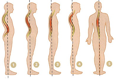 Massatges d'esquena i coll, cos, amb osteocondrosi. Com triar per a ús domèstic