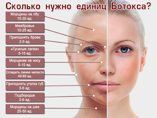 Anatomy of human facial muscles in cosmetology for botox injections. Schemes with descriptions and photos in Latin and Russian