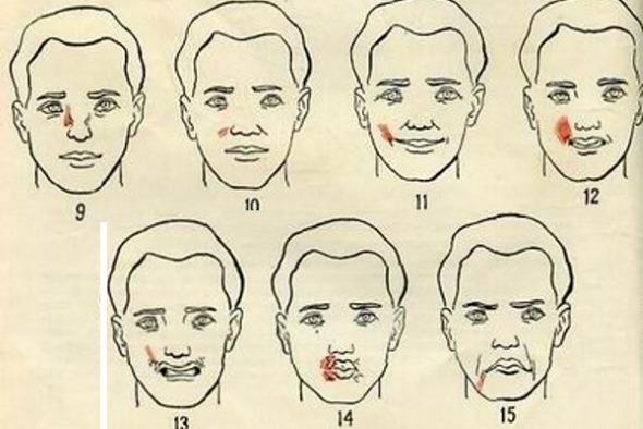 Anatomie der menschlichen Gesichtsmuskulatur in der Kosmetik für Botox-Injektionen. Schemata mit Beschreibungen und Fotos in Latein und Russisch