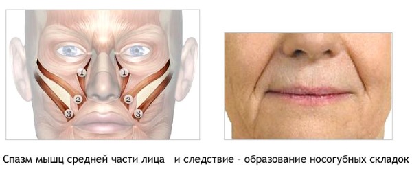 Giải phẫu cơ mặt người trong ngành thẩm mỹ tiêm botox. Lược đồ có mô tả và hình ảnh bằng tiếng Latinh và tiếng Nga