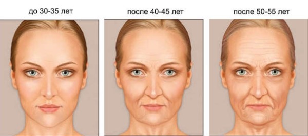 تشريح عضلات وجه الإنسان في التجميل لحقن البوتوكس. مخططات مع الأوصاف والصور باللغتين اللاتينية والروسية