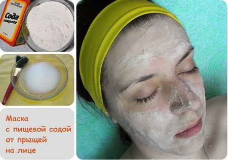 Subcutaneous acne on the face. Reasons how to get rid. Fast treatment with folk remedies, ointments, medicines at home