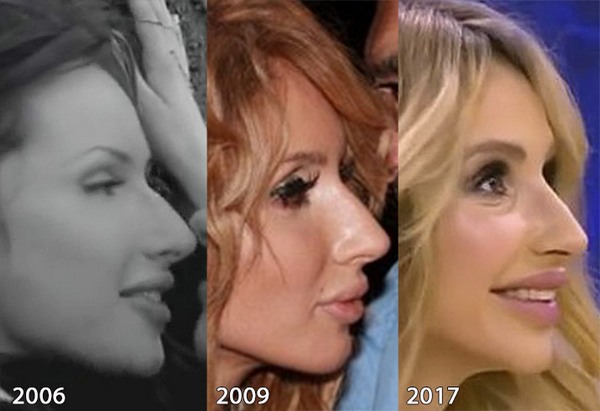 Svetlana Loboda antes e depois da cirurgia plástica. Foto de rosto, nariz, lábios, tórax. Biografia do cantor, idade, parâmetros de forma, altura e peso