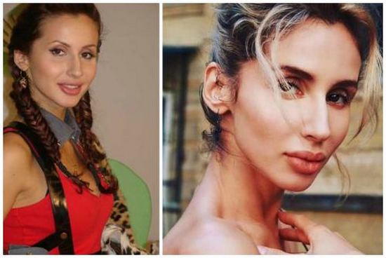 Svetlana Loboda trước và sau khi phẫu thuật thẩm mỹ. Ảnh chụp mặt, mũi, môi, ngực. Tiểu sử ca sĩ, tuổi, các thông số hình dạng, chiều cao và cân nặng