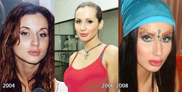 Svetlana Loboda antes y después de la cirugía plástica. Foto de cara, nariz, labios, pecho. Biografía del cantante, edad, parámetros de forma, altura y peso.