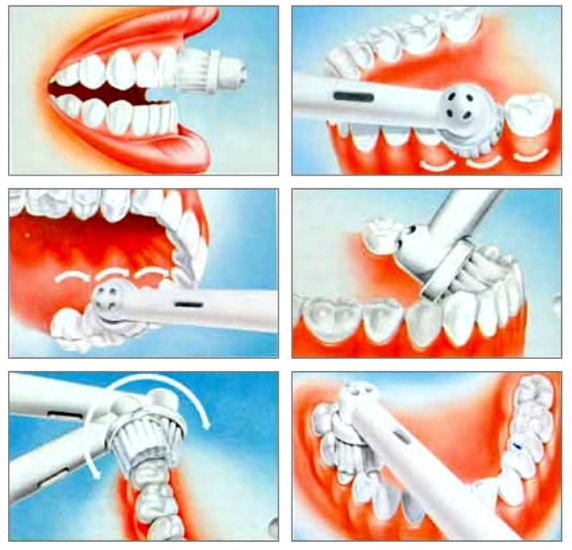 Ultrasone tandenborstel. Voors en tegens, doktersrecensies, beoordeling van de beste en contra-indicaties