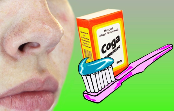 Come applicare il dentifricio per l'acne sul viso. Ricetta per la preparazione e l'uso, foto