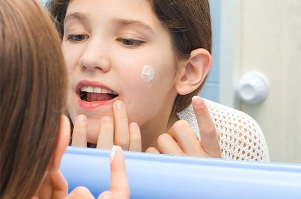 كيفية تطبيق معجون الأسنان على حب الشباب على الوجه. وصفة للتحضير والاستخدام ، الصورة