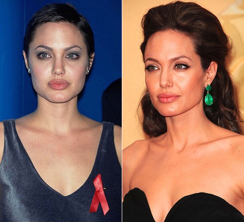 Angelina Jolie voor en na plastische chirurgie. Een selectie van foto's van de actrice voor en na de neuscorrectie, plasmalifting