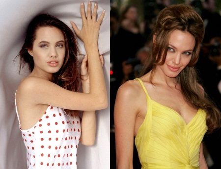 Angelina Jolie sebelum dan selepas pembedahan plastik. Pilihan gambar pelakon sebelum dan selepas operasi rhinoplasty, mengangkat plasma