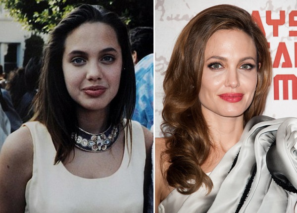 أنجلينا جولي قبل وبعد الجراحة التجميلية. صور مختارة للممثلة قبل وبعد عمليات تجميل الانف وعمليات رفع البلازما