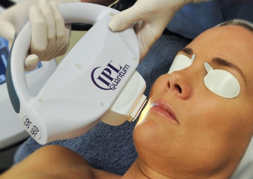 Apparatuur voor het verwijderen van ouderdomsvlekken, littekens, tatoeages op het gezicht en de lichaamshuid. Laser, Fraxel, Elos, M22. Beoordeling en recensies