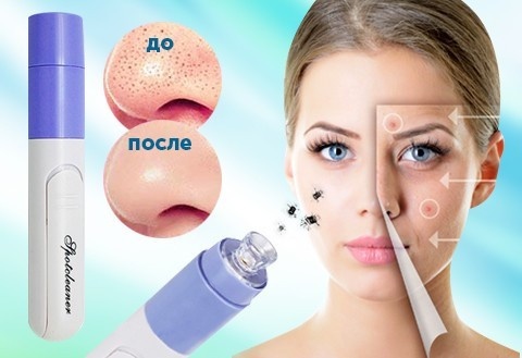 Dispositivi per la pulizia del viso. Specie, Top 5 Migliori per uso domestico. Come scegliere come utilizzare
