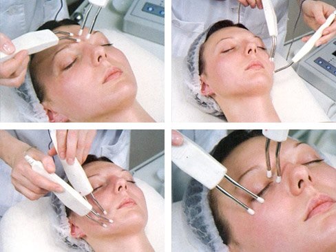 Elektroplating dalam kosmetologi - apa sebenarnya, bagaimana prosedur dilakukan untuk kulit di sekitar mata, muka dan badan, kebaikan dan keburukan, faedah. Radas untuk kegunaan rumah. Gambar