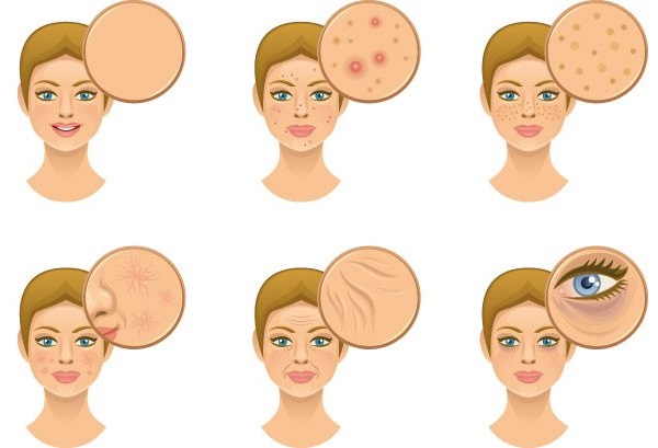 Галванизација у козметологији - шта је то, како се раде поступци за кожу око очију, лица и тела, за и против, предности. Апарати за кућну употребу. Фото