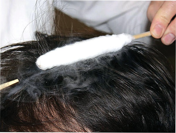 Cryothérapie - indications et contre-indications en cosmétologie pour le visage, les cheveux, la perte de poids, le déroulement de la procédure, les résultats, les photos