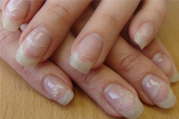 Tratamento de unhas em mãos e pés após esmalte gel, extensão. Receitas populares, produtos farmacêuticos, sistema IBX