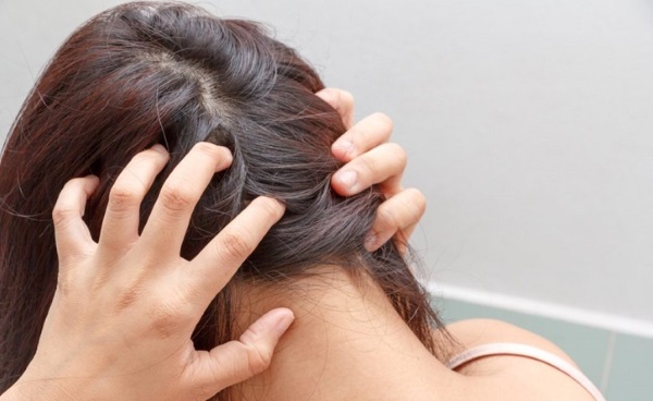 Minoxidil para cabelos: como funciona, eficácia, antes e depois das fotos, avaliações. Como aplicar a mulheres e homens, efeitos colaterais, possíveis danos. Preço e comentários