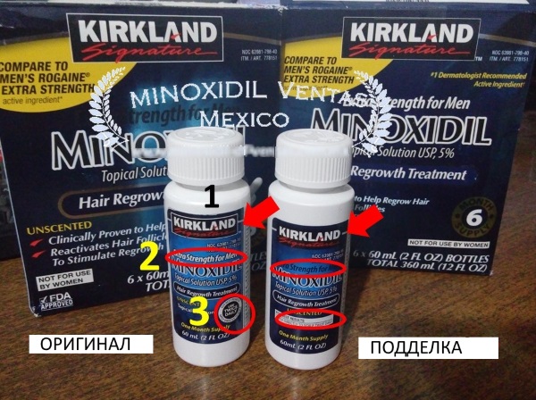 Minoxidil para el cabello: cómo funciona, efectividad, fotos de antes y después, reseñas. Cómo aplicar en mujeres y hombres, efectos secundarios, posibles daños. Precio y opiniones