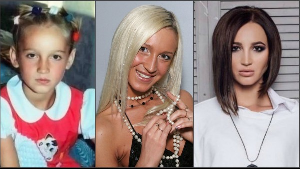 Olga Buzova: fotos abans i després de la cirurgia plàstica del nas, llavis, pòmuls. Com vaig aprimar, quina cirurgia plàstica vaig fer