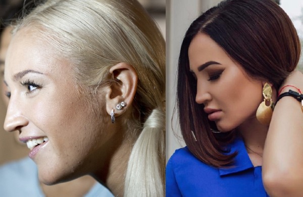 Olga Buzova - foto's voor en na plastische chirurgie van de neus, lippen, jukbeenderen. Hoe ben ik afgevallen, welke plastische chirurgie heb ik gedaan
