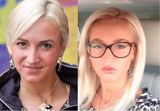 Olga Buzova - foto prima e dopo la chirurgia plastica del naso, delle labbra, degli zigomi. Come ho perso peso, che chirurgia plastica ho fatto