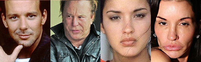 Cirurgia plástica sem sucesso. Fotos de assustadoras estrelas russas e de Hollywood, homens e mulheres