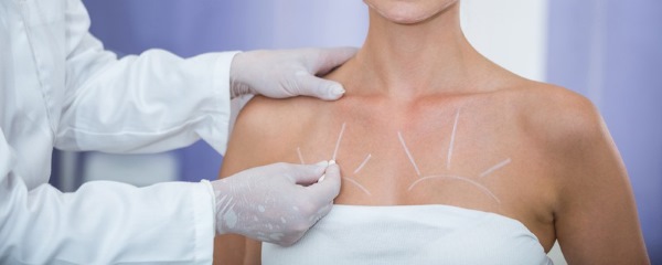 Cirugía plástica de mama. Indicaciones de cómo se realiza la operación con y sin implantes, resultados, fotos, consecuencias