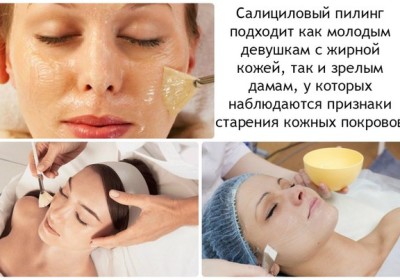 Výhody a poškození peelingu na obličej: chemikálie, ovocné kyseliny, glykolová, hardware, retinol, Jessner, kyselina jantarová, s vápníkem