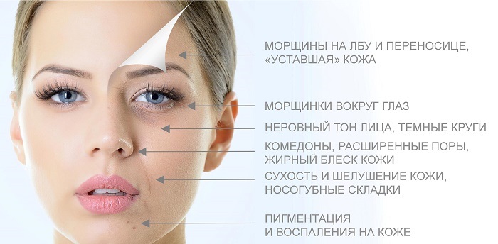 Topp 10 professionella ultraljudsmaskiner för rengöring av ansiktshuden hemma. Recensioner, foton och resultat