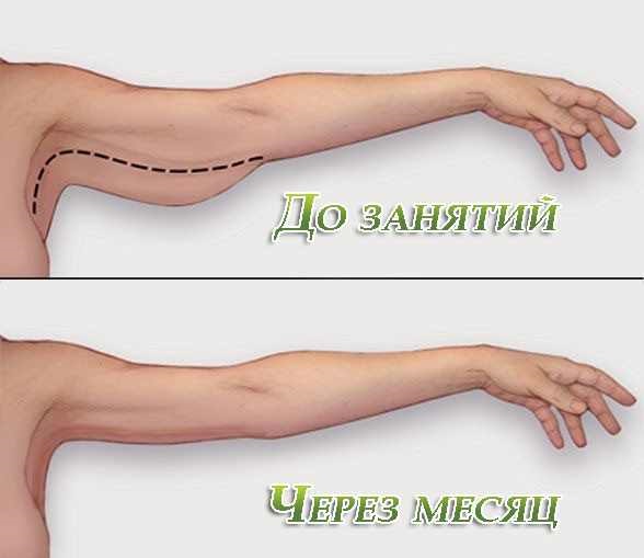 Gyakorlatok karok és vállak karcsúsítására nőknek súlyzókkal és anélkül, fotókkal és videókkal