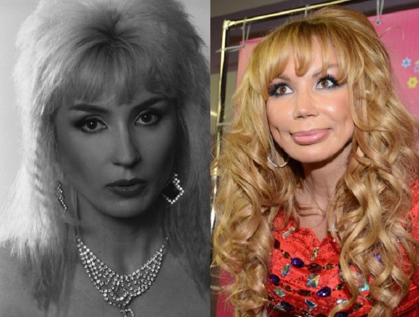 Opfer der plastischen Chirurgie: Russische Prominente und Stars auf der ganzen Welt, Männer und Frauen. Vor und nach Fotos