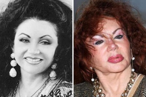 Vítimas de cirurgia plástica: celebridades russas e estrelas de todo o mundo, homens e mulheres. Fotos antes e depois