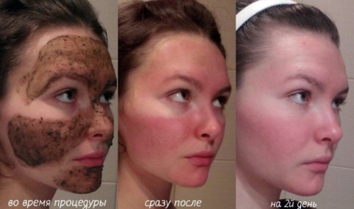 Cheminis veido šveitimas salone ir namuose. Atsiliepimai prieš ir po nuotraukų, už ir prieš
