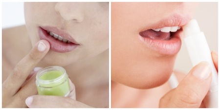 Wie man die Lippen mit Hyaluronsäure, Botox, Silikon, Lipofilling, Cheiloplastik vergrößert. Ergebnisse: vor und nach Fotos, Preisen, Bewertungen