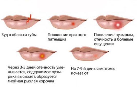 Masti za ožiljke i ožiljke na licu nakon akni, vodenih kozica, blefaroplastike, operacije.Učinkovita i jeftina sredstva