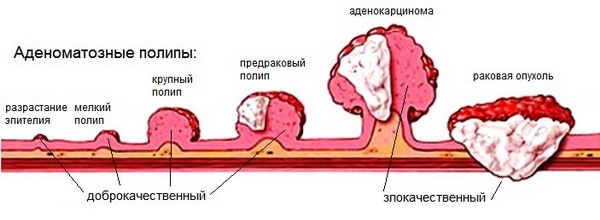 Neoplasma kulit: gambar dan keterangan di kepala, lengan, muka dan badan. Cara merawat neoplasma jinak dan malignan