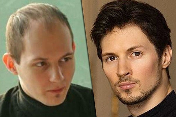 Павел Дуров. Фотографије пре и после пластичне хирургије. Како је изгледао творац Вконтакте, биографија и лични живот