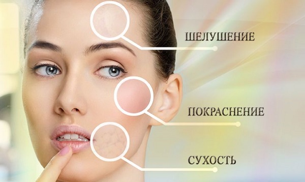 Exfoliantes faciales ácidos: formulaciones profesionales para uso doméstico. Eficiencia y como usar