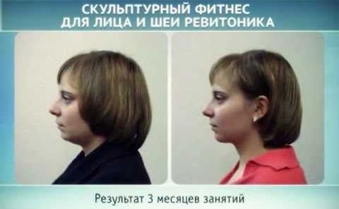Revitonika. Un vídeo detallat dels exercicis bàsics de Natalia Osminina, Anastasia Dubinskaya. Ressenyes de metges