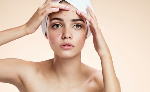 Salicyl-Peeling für das Gesicht - was ist das, Wirksamkeit, wie wird es gemacht? Hausmittel Rezepte