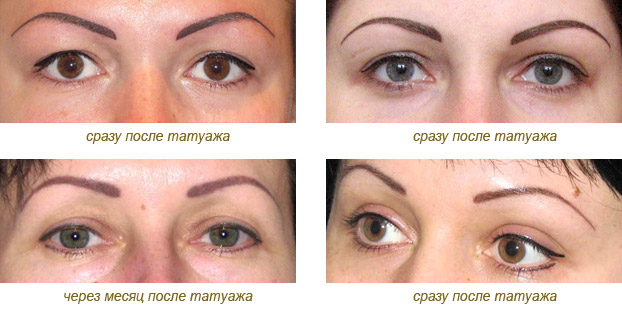 Permanenteng make-up ng mga eyelid na may shading, arrow, inter-eyelash, anino, upper at lower eyelids. Bago at pagkatapos ng mga larawan, kung gaano katagal, ang mga kahihinatnan