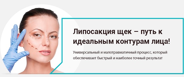 Facial thermage - what is this procedure, how is it done, what is the difference with RF-lifting. Photos, results, price, reviews