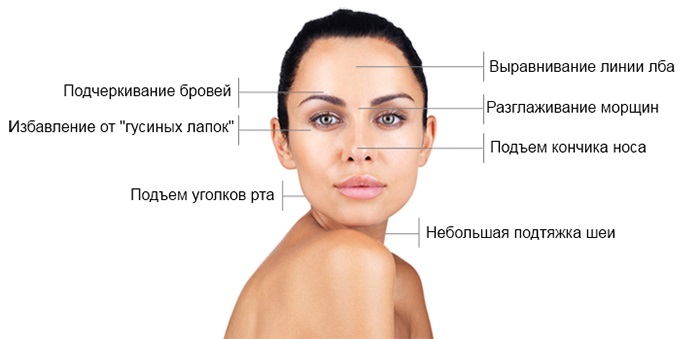 Inyecciones de Botox para las arrugas faciales. Fotos antes y después, precio, consecuencias, contraindicaciones del procedimiento.