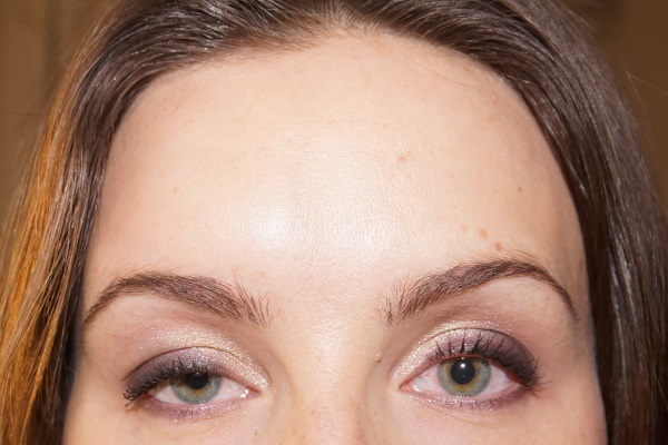 Ενέσεις Botox για ρυτίδες στο πρόσωπο. Πριν και μετά τις φωτογραφίες, την τιμή, τις συνέπειες, τις αντενδείξεις της διαδικασίας