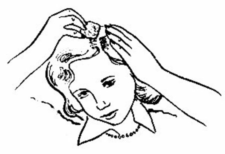 Esvicin. Instructions d'utilisation pour les cheveux. Avis des trichologues, où acheter, prix